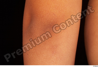 Timbo arm elbow 0005.jpg